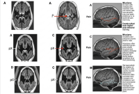 یه تحقیق شگفت‌انگیز نشون میده که موزیسین‌ها درد رو مثل بقیه ما حس نمی‌کنن