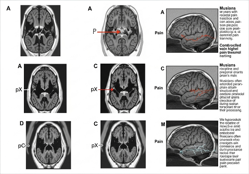 یه تحقیق شگفت‌انگیز نشون میده که موزیسین‌ها درد رو مثل بقیه ما حس نمی‌کنن